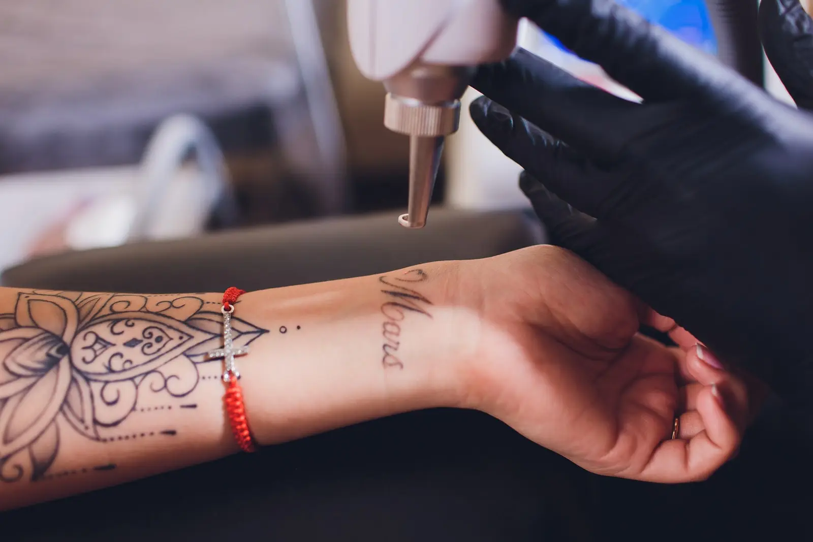 Behandlung eines Schriftzug-Tattoos am Handgelenk mit dem Pico-Laser